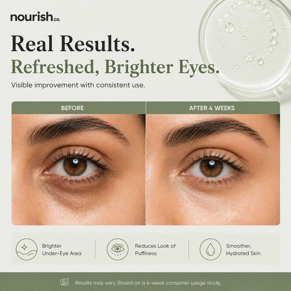 Under Eye Serum with Vitamin C, Niacinamide & Retinol – 15 ml - nourish co